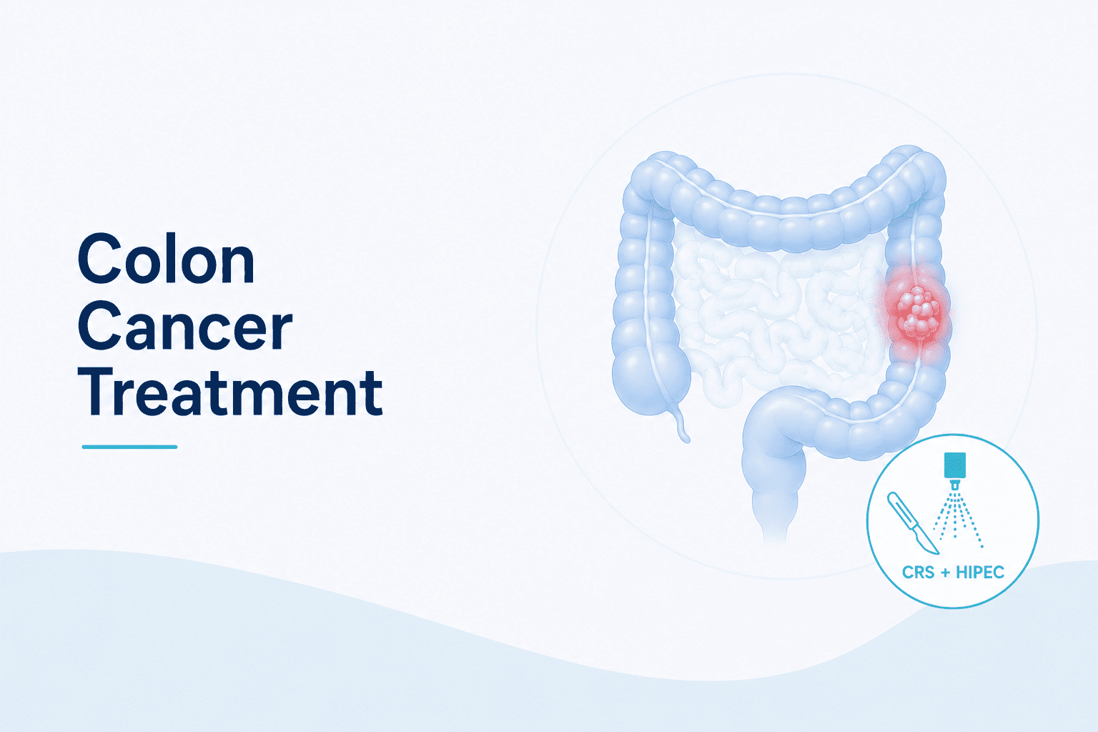 Best Colon Cancer Treatment in Mulund