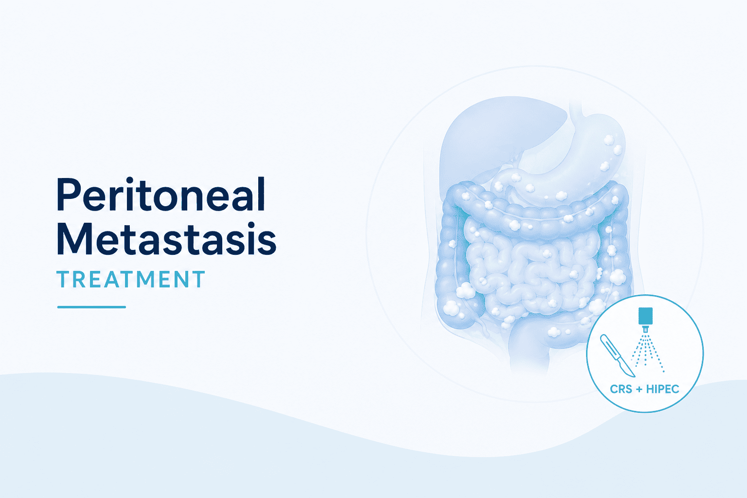 Best Peritoneal Metastasis Treatment in Mulund