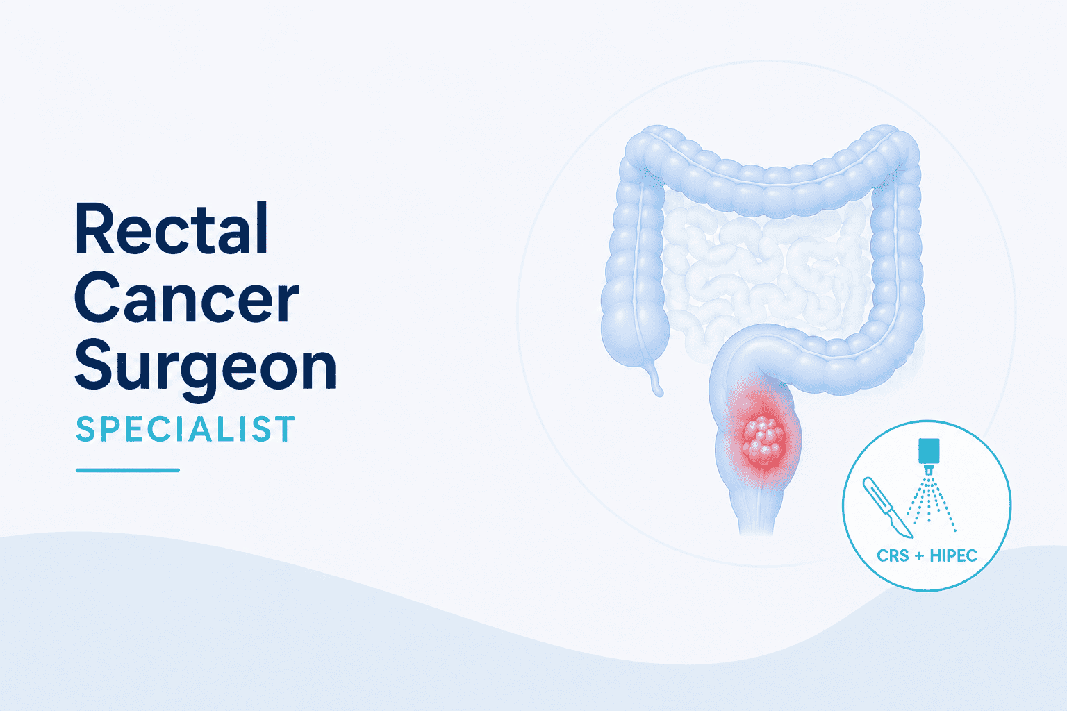 Best Rectal Cancer Surgeon in Mulund