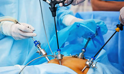 Minimally Invasive Surgery MIS TME